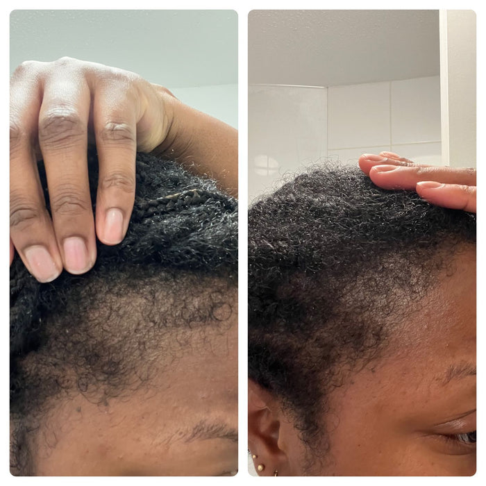 Follicle Fuel Pro+ Growth Potion (Extra Strength)