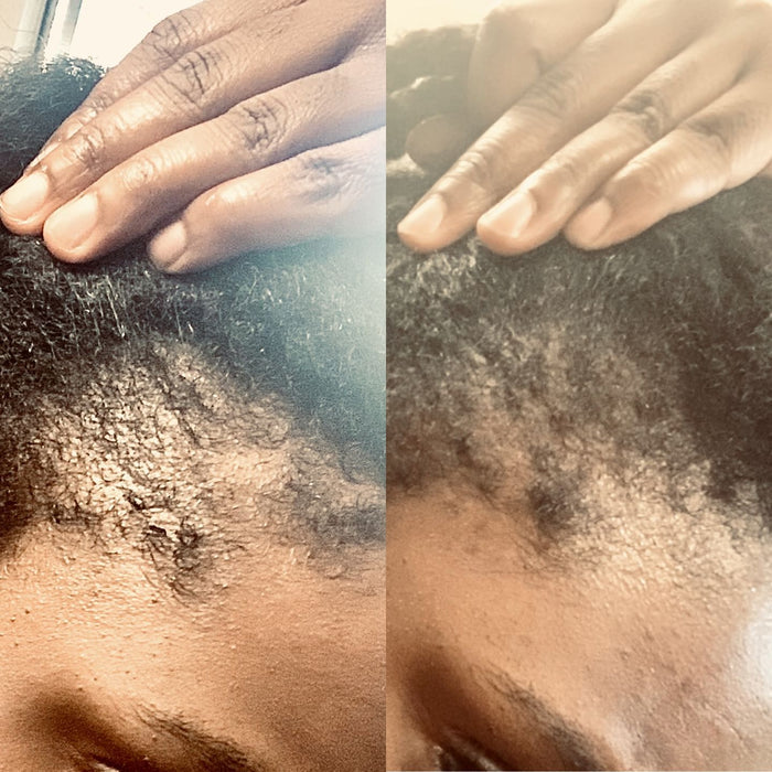 Follicle Fuel Pro+ Growth Potion (Extra Strength)