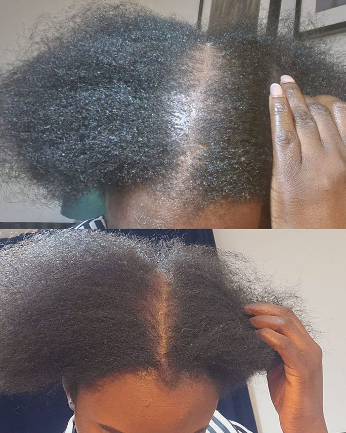 Follicle Fuel Pro+ Growth Potion (Extra Strength)