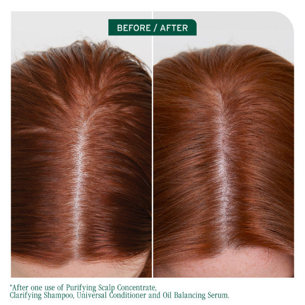 Matrix Biolage Scalp Sync Clarifying Shampoo 400ml *NEW*