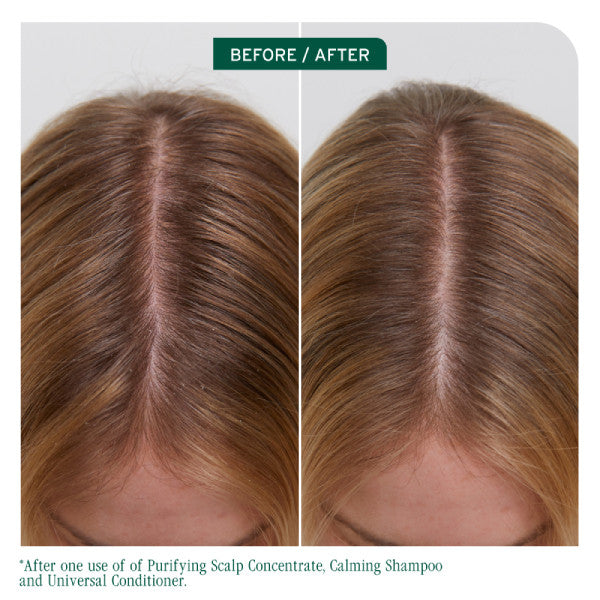 Matrix Biolage Scalp Sync Universal Conditioner 236ml *NEW*