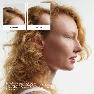 Nioxin System 4 Kit - For Coloured Hair with Progressed Thinning