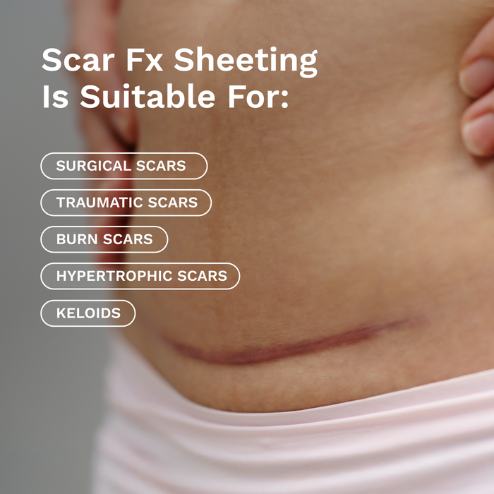 Scar FX Sheeting suitability for scars on a person's skin with text overlay.