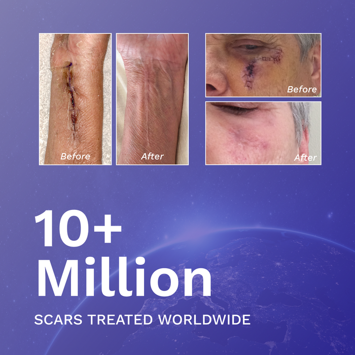 Scar Fx silicone sheeting product image 4