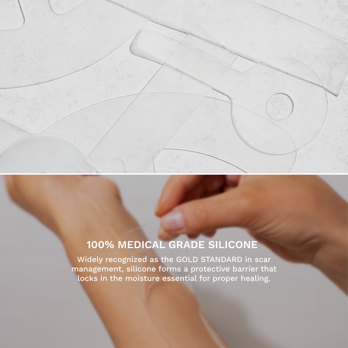 Scar Fx silicone sheeting product image 7
